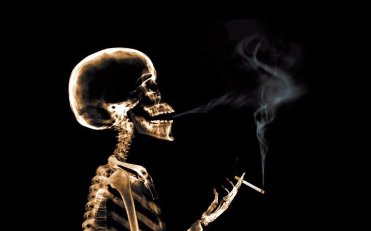 سیگار کشیدن به عنوان علت کمردرد در ناحیه تیغه های شانه