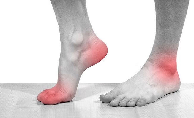 درد در مفاصل مچ پا همراه با آرتروز